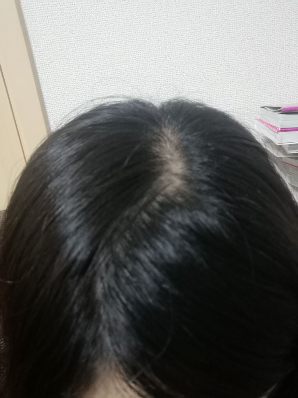 スカルプD ボーテ ナチュラスター スカルプシャンプー/トリートメントパック/アンファー(スカルプD)/シャンプー・コンディショナーを使ったクチコミ(4枚目)