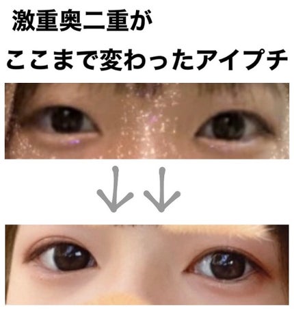 TWOOLダブルアイリッドハイブリットフィルム/SHOBIDO/二重まぶた用アイテムを使ったクチコミ(1枚目)