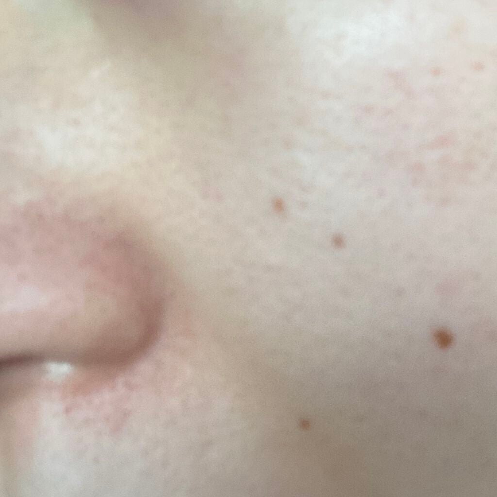 トーニング ローション ドライ/ノーマル/CLARINS/化粧水を使ったクチコミ(6枚目)