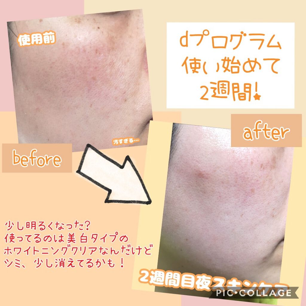 ホワイトニングクリアエマルジョン/d プログラム/乳液を使ったクチコミ（1枚目）