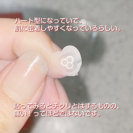 ACマグネシウムパッチ ミニ/スノーツープラス/にきびパッチを使ったクチコミ(4枚目)