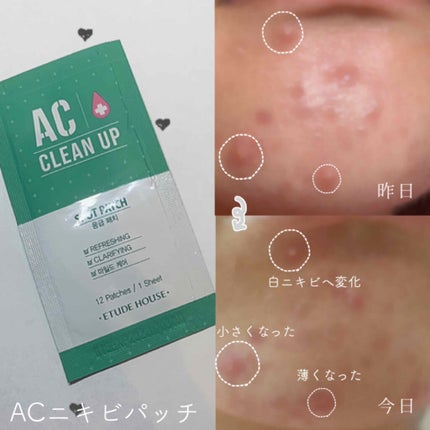 ACC パッチ/ETUDE/シートマスク・パックを使ったクチコミ(2枚目)