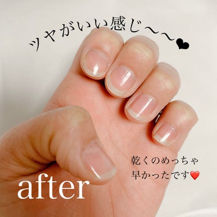 ディーアップファンデーション/D-UP/ネイルベースコートを使ったクチコミ(3枚目)