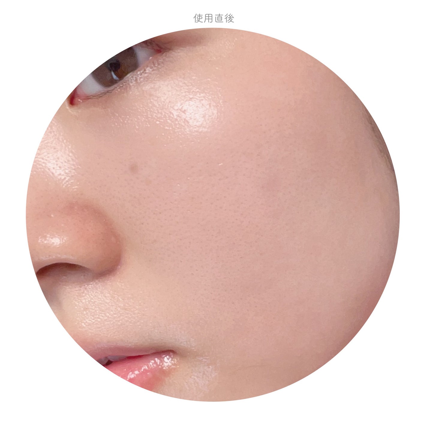 メラジュランナイアシン15トーニングセラム/MEDITHERAPY/美容液を使ったクチコミ(5枚目)