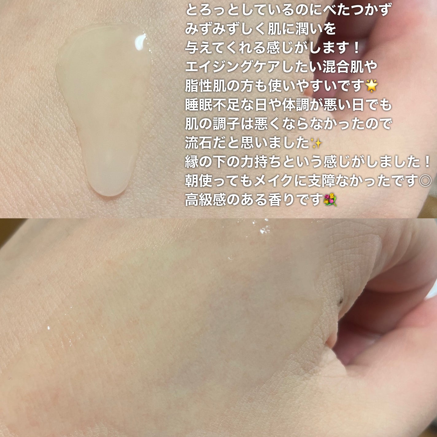 アルティミューン™ パワライジング セラム/SHISEIDO/美容液を使ったクチコミ(4枚目)