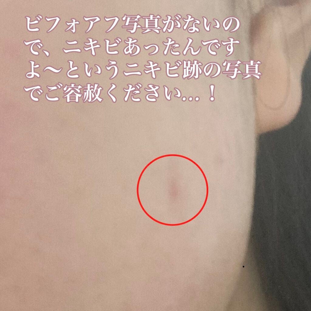 レシピオ モイストローションM /レシピオ/化粧水を使ったクチコミ(3枚目)