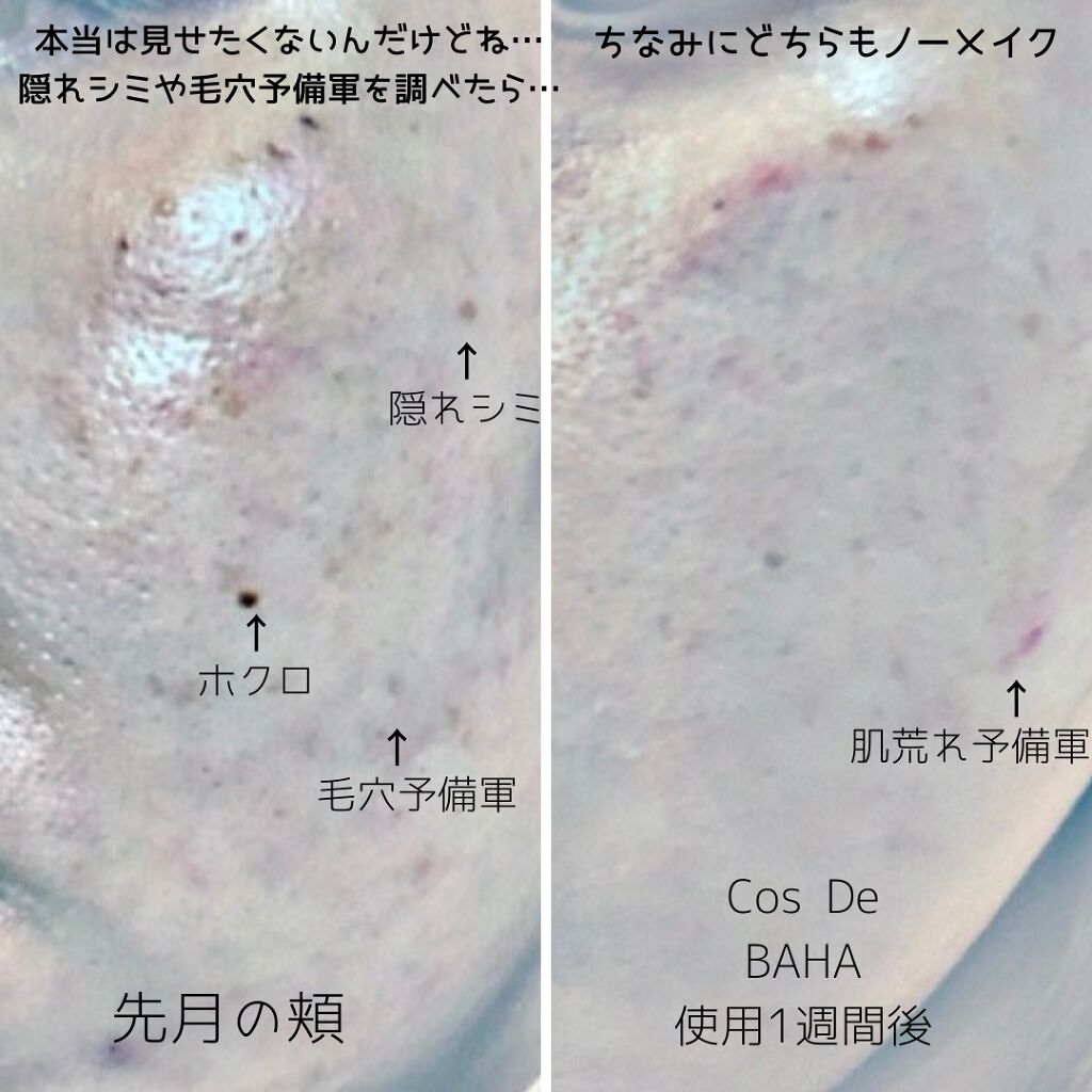 TN トラネキサム 5% ナイアシンアミド ライトニング セラム/Cos de BAHA/美容液を使ったクチコミ(6枚目)