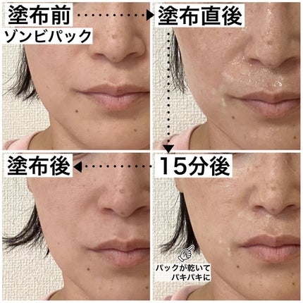 センテラ アンプル/SKIN1004/美容液を使ったクチコミ(4枚目)