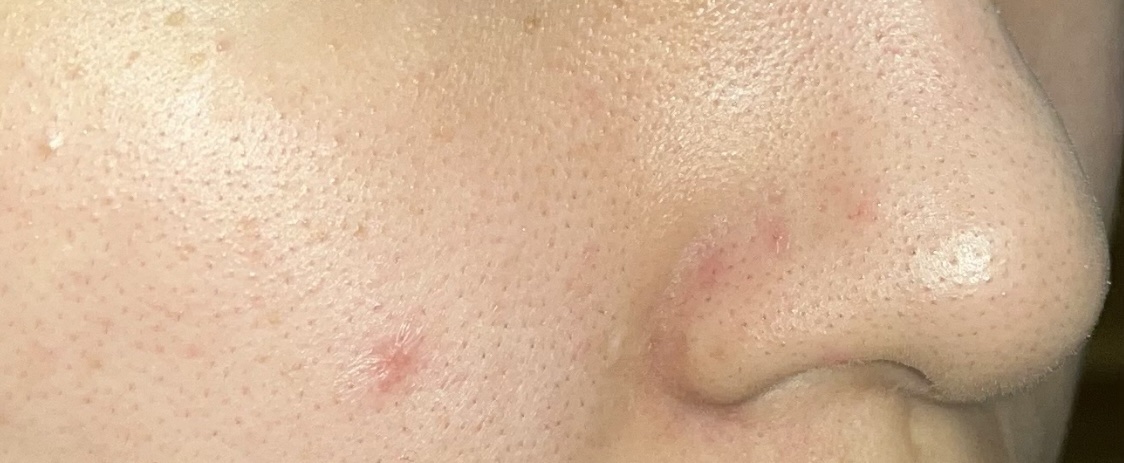 ノーモアブラックヘッド(ノーズピーリング)/One-day's you/スクラブ・ゴマージュを使ったクチコミ（3枚目）