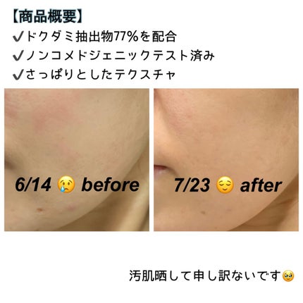 ドクダミ 77 スージングトナー/Anua/化粧水を使ったクチコミ(2枚目)