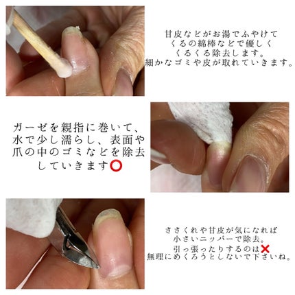 Suzukið§žð§ž on LIPS ã以åãã³ãã±ã¢ãèŒããæã詳ããçªã®ã±ã¢æ¹æ³çãèŒãããïŒãšæ..ãïŒ6æç®ïŒ