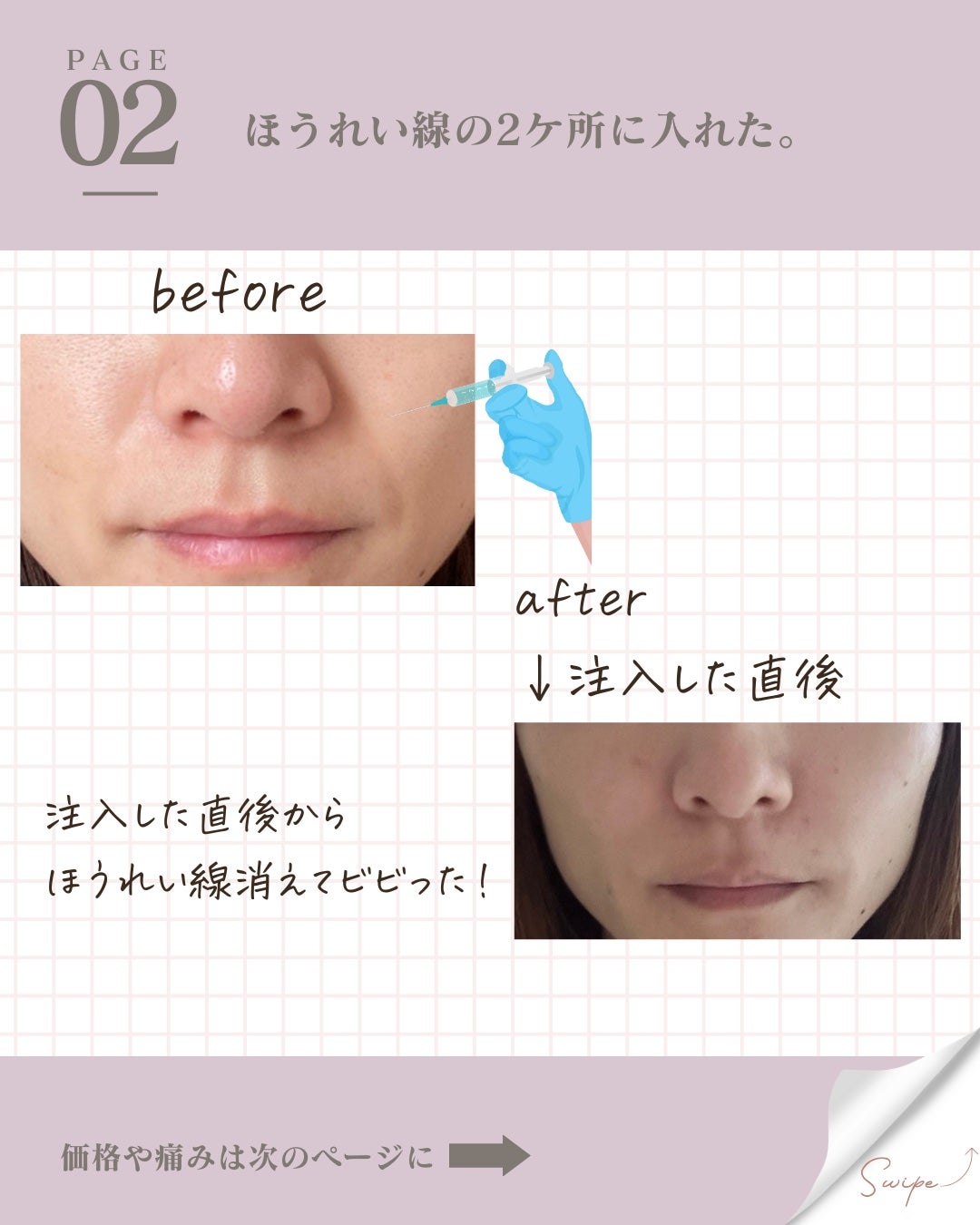 ããð¯æ¯ç©Žã¬ã¹ÃçŸçœéææã远æ±ð on LIPS ããã¢ã«ãã³é
žæ³šå°ðããŒã£ãšè¿·ã£ãŠããŠãéã«ãã£ãŠããŸããå
..ãïŒ3æç®ïŒ