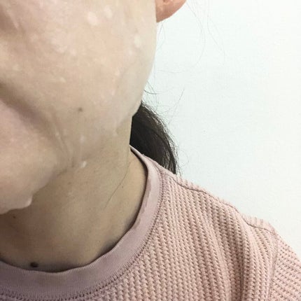 Youthful Radiance Edelweiss & Pomegranate Sheet Mask/Himalaya Herbals/シートマスク・パックを使ったクチコミ(4枚目)