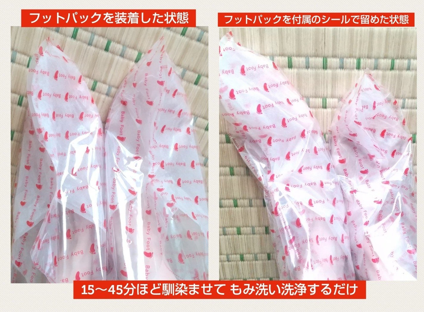 ベビーフット 重曹殺菌消毒洗浄剤/ベビーフット/レッグ・フットケアを使ったクチコミ(4枚目)