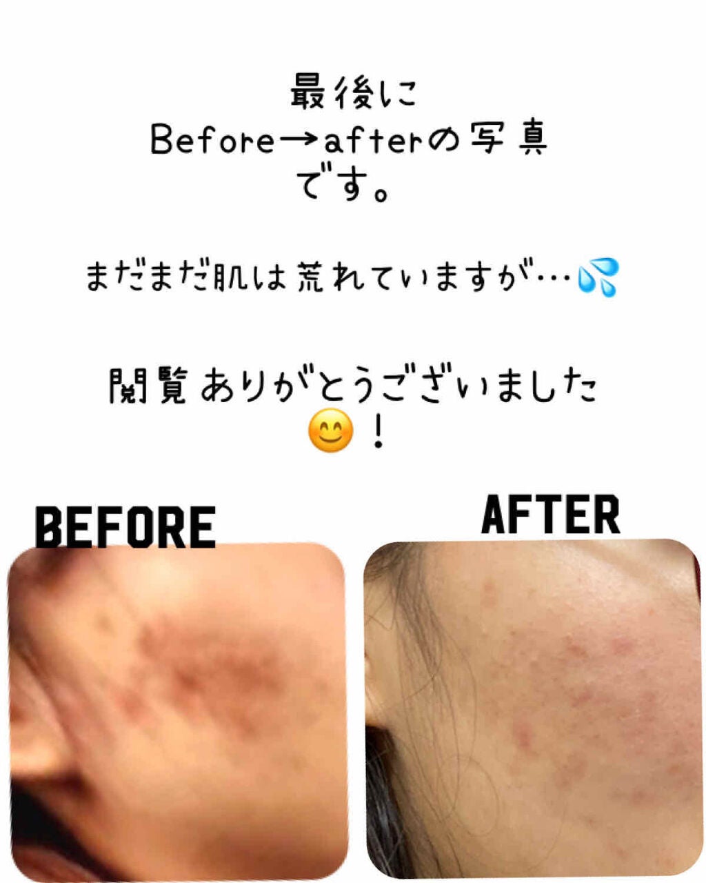 マダムジュジュ 恋する肌/ジュジュ/フェイスクリームを使ったクチコミ(4枚目)