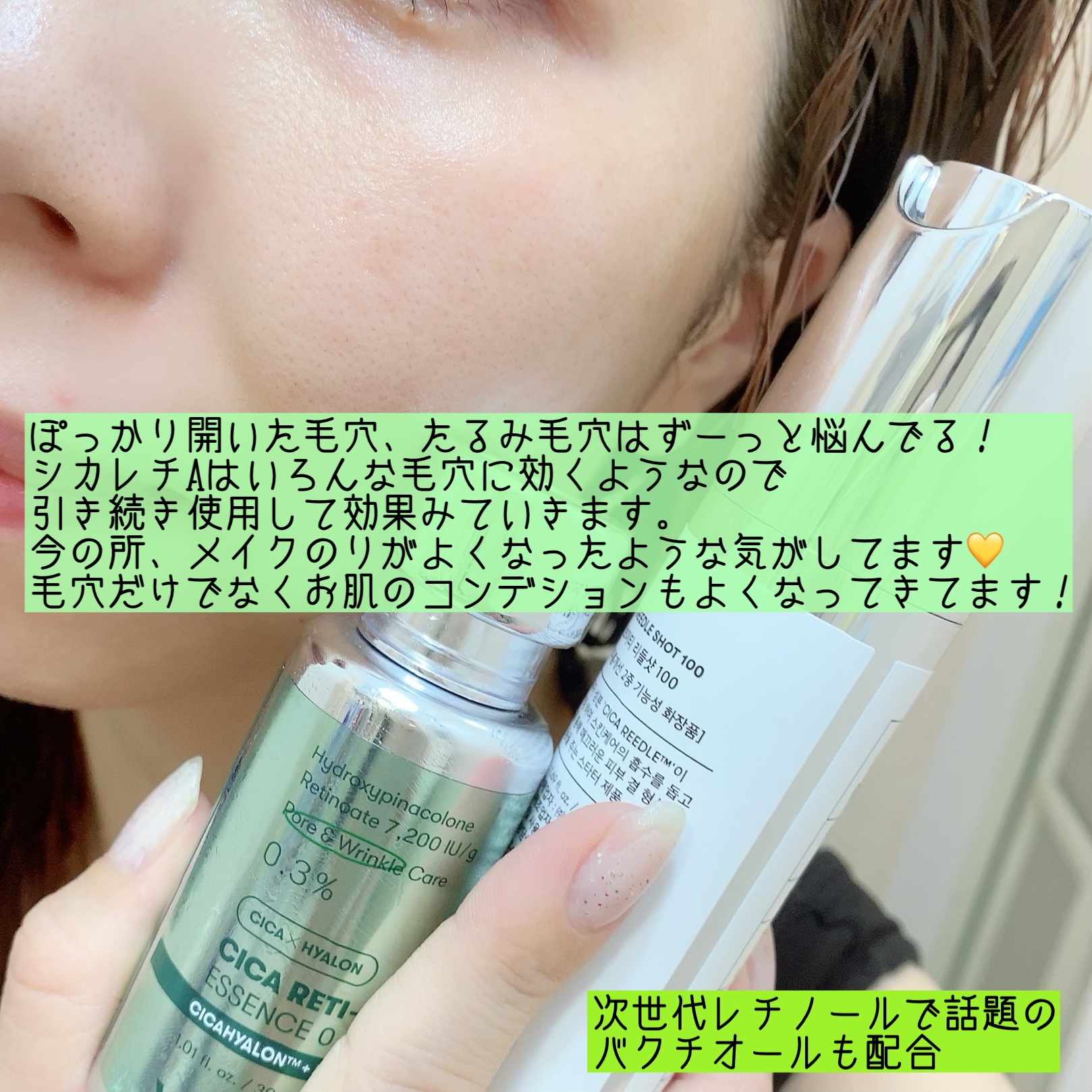 シカレチA エッセンス0.1/VT/美容液を使ったクチコミ（3枚目）