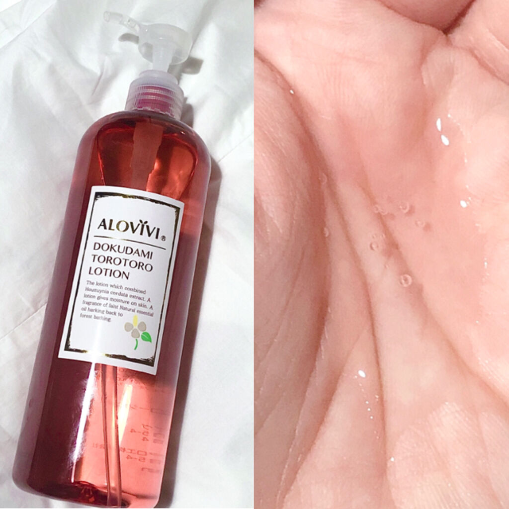どくだみとろとろローション/アロヴィヴィ/化粧水を使ったクチコミ（2枚目）