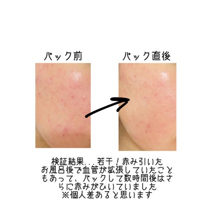 CICA デイリースージングマスク/VT/シートマスク・パックを使ったクチコミ(3枚目)