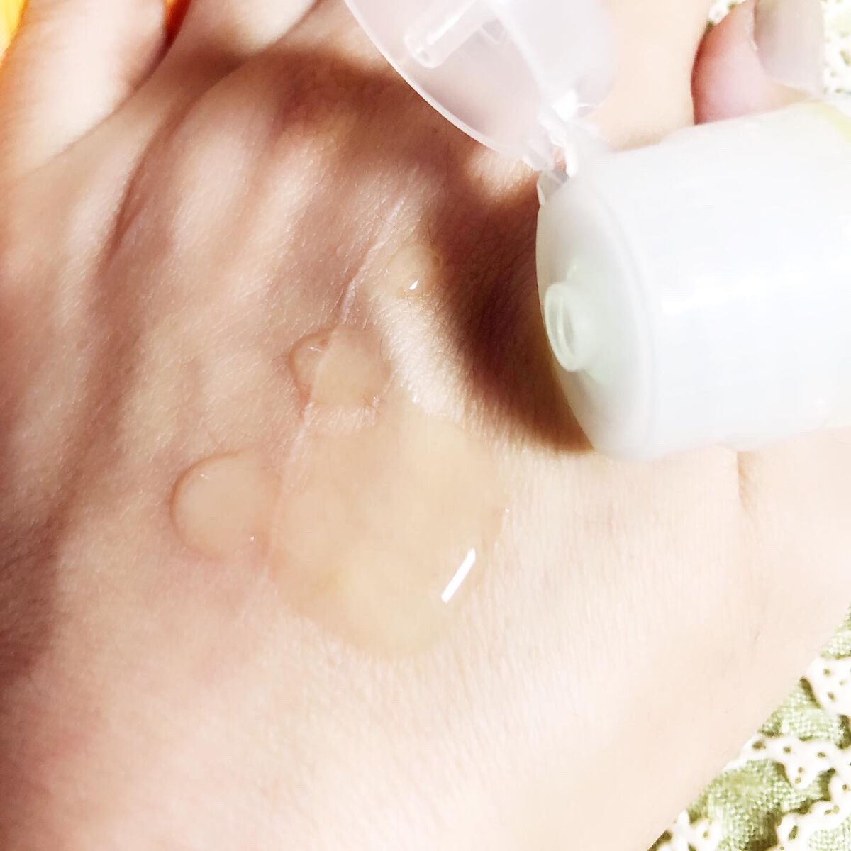 アクネケア 化粧液　＜医薬部外品＞/ファンケル/化粧水を使ったクチコミ（2枚目）