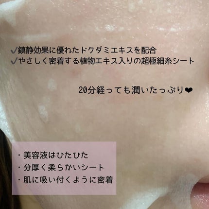 ドクダミ77 % 鎮静マスクパック/Anua/シートマスク・パックを使ったクチコミ(2枚目)