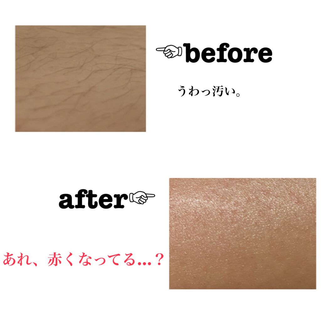 つるすべ除毛パッド/DAISO/ムダ毛ケアを使ったクチコミ（2枚目）