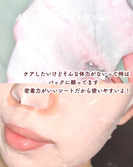 薬用ルルルン 美白アクネ/ルルルン/シートマスク・パックを使ったクチコミ(8枚目)