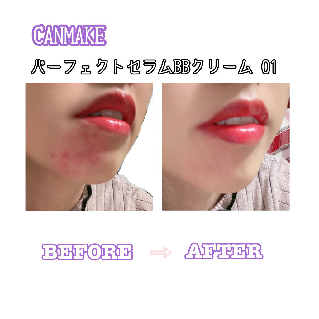 パーフェクトセラムBBクリーム/キャンメイク/BBクリームを使ったクチコミ（1枚目）