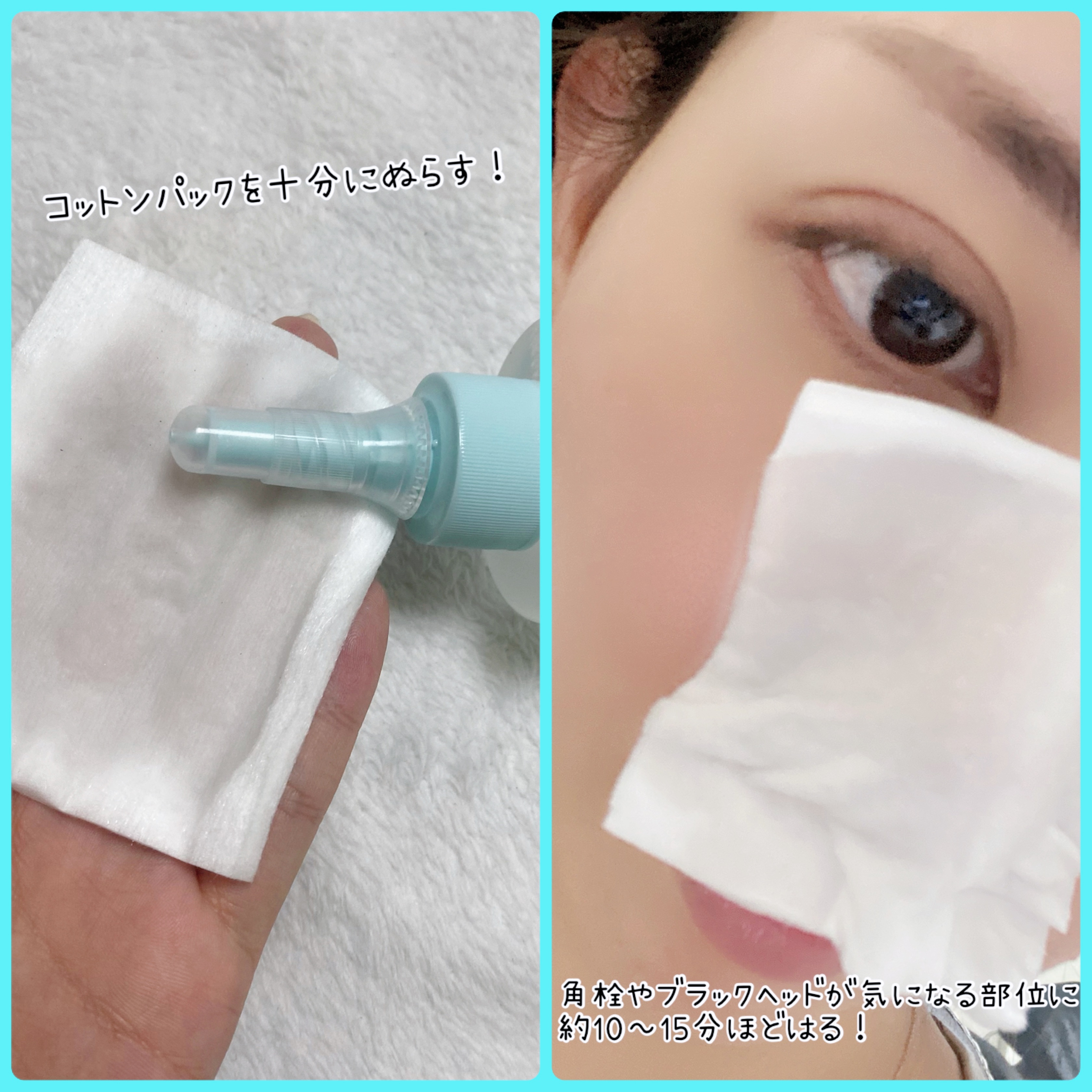 ILSO　スーパーメルティング セバムソフトナー/ilso/化粧水を使ったクチコミ（2枚目）