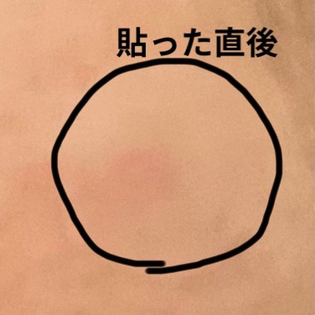 プロCICA クリアスポットパッチ/VT/その他スキンケアを使ったクチコミ(2枚目)