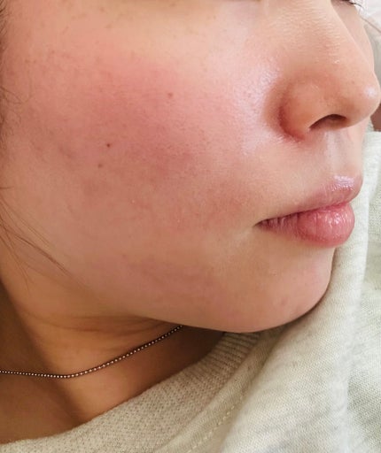 リンクルUV乳液/なめらか本舗/日焼け止めミルクを使ったクチコミ(1枚目)