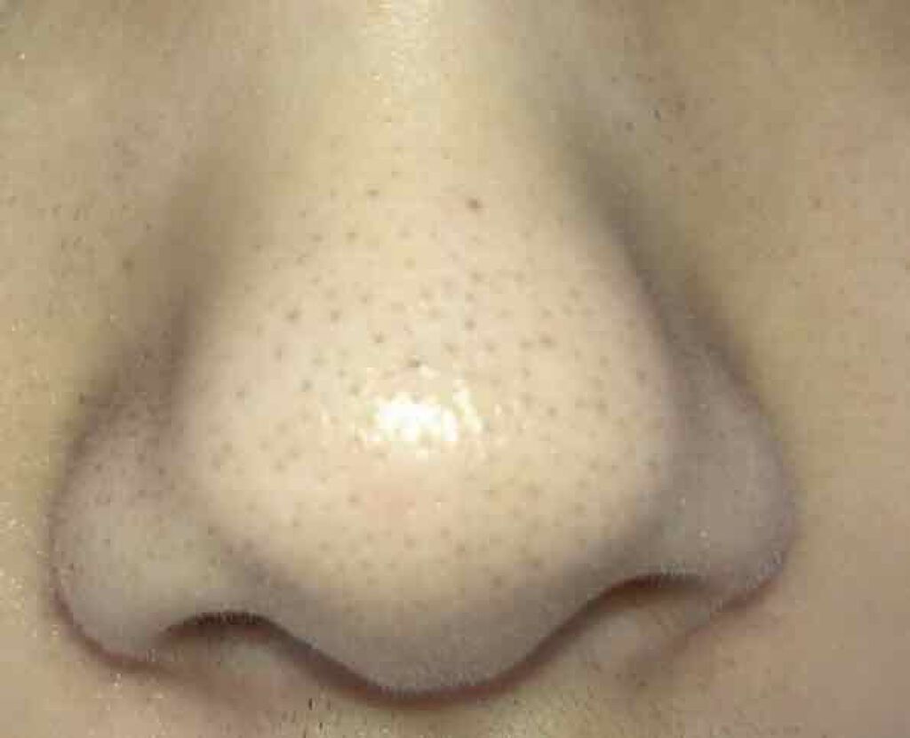 ホホバオイル/無印良品/ボディオイルを使ったクチコミ（2枚目）