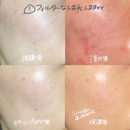 AHA 30% + BHA 2% Peeling Solution/The Ordinary/ピーリングを使ったクチコミ(3枚目)