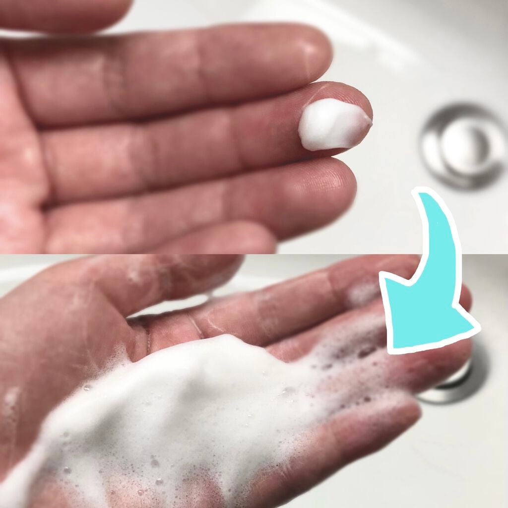 パーフェクトホイップ アクネケア/SENKA(専科)/洗顔フォームを使ったクチコミ(2枚目)