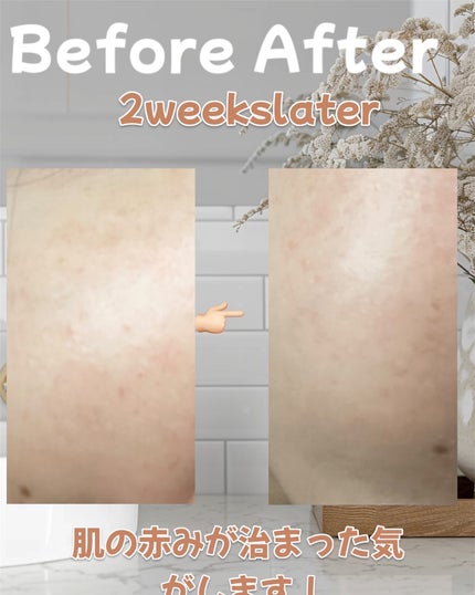 バイオームバリア クリームミスト/UIQ/ミスト状化粧水を使ったクチコミ(10枚目)