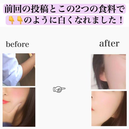 キレートレモン/Pokka Sapporo (ポッカサッポロ)/美容ドリンクを使ったクチコミ(4枚目)