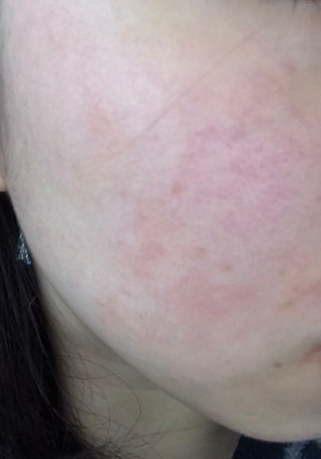 モイスチュア エマルジョン/カルテHD/乳液を使ったクチコミ(1枚目)