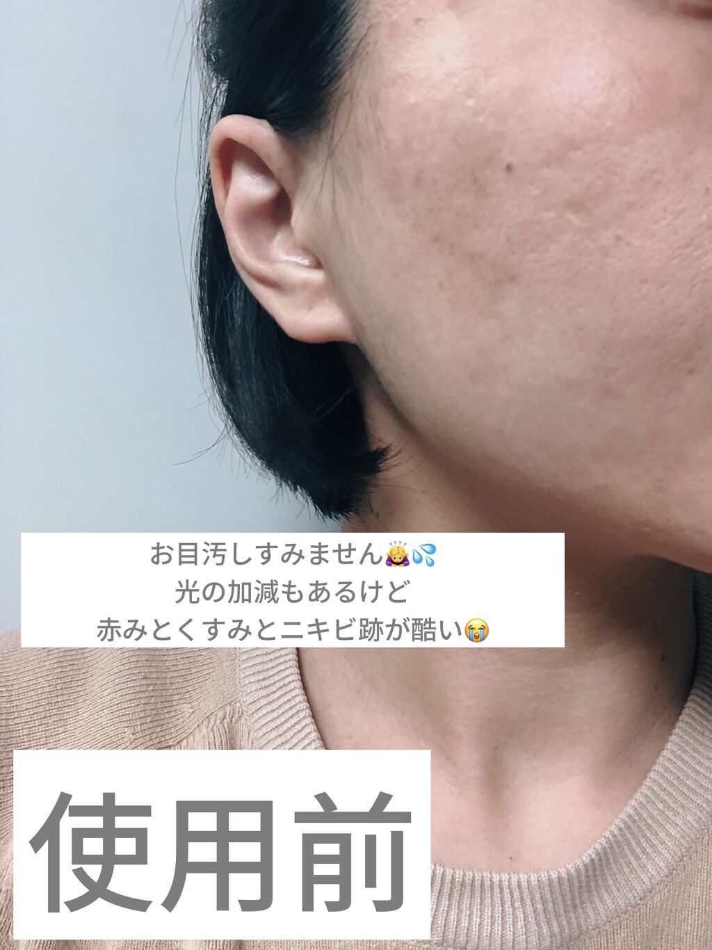 オーガニアンス ウォータリー エッセンス/primera/化粧水を使ったクチコミ（2枚目）