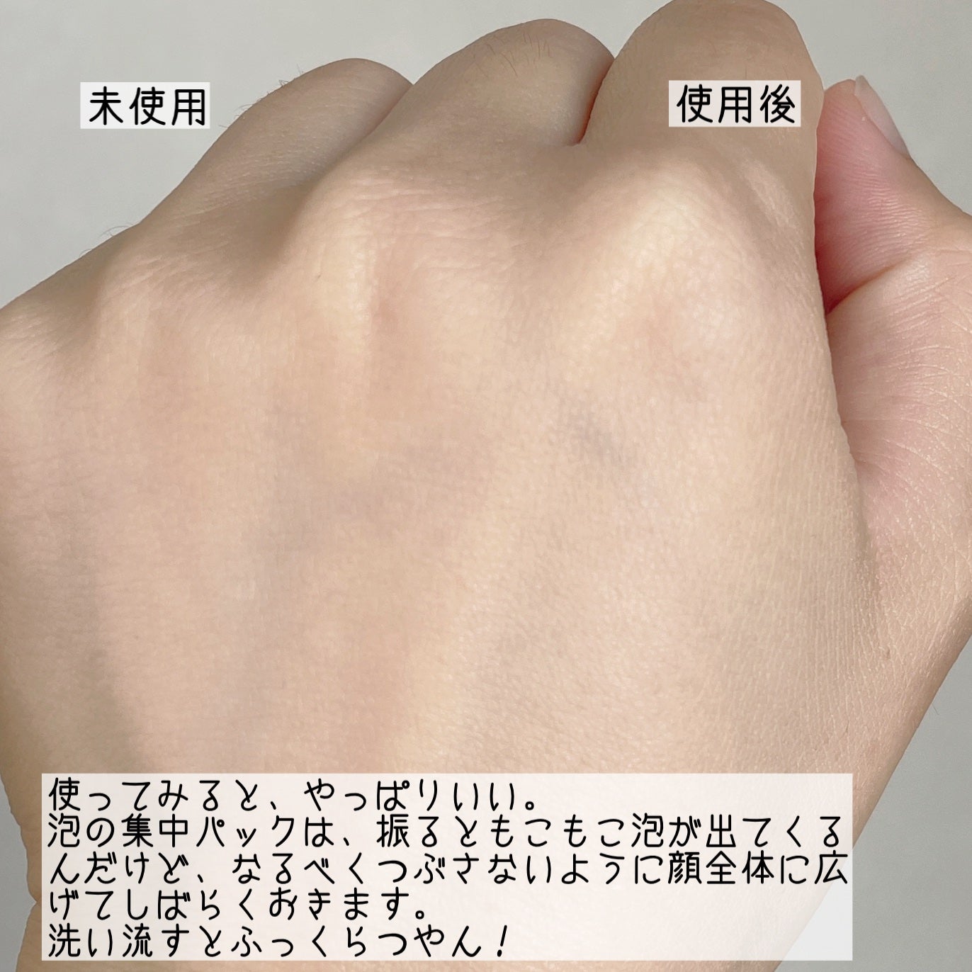 泡の集中パック/ドモホルンリンクル/洗い流すパック・マスクを使ったクチコミ(4枚目)