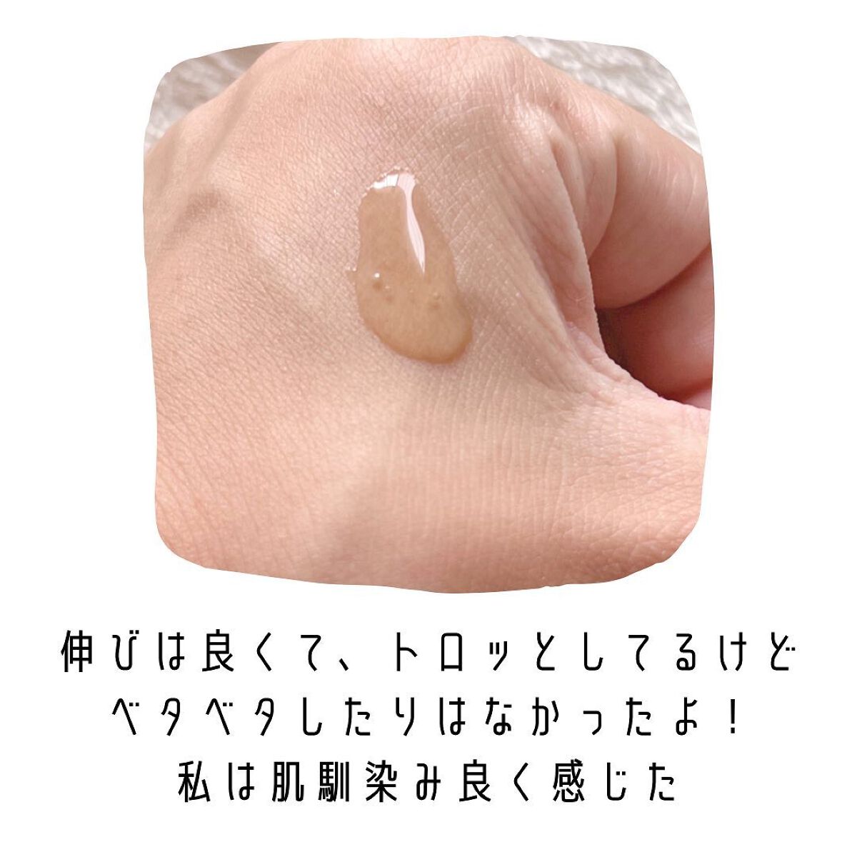 シカテロル美容液/beplain/美容液を使ったクチコミ(5枚目)