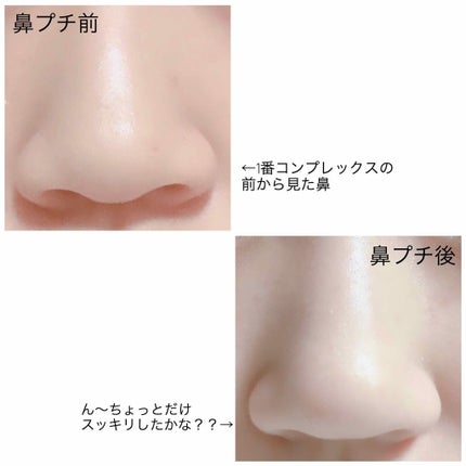 オノミヤ on LIPS 「鼻プチレビュー👃私は自分の顔で一番鼻がコンプレックスで悩んでい..」(3枚目)