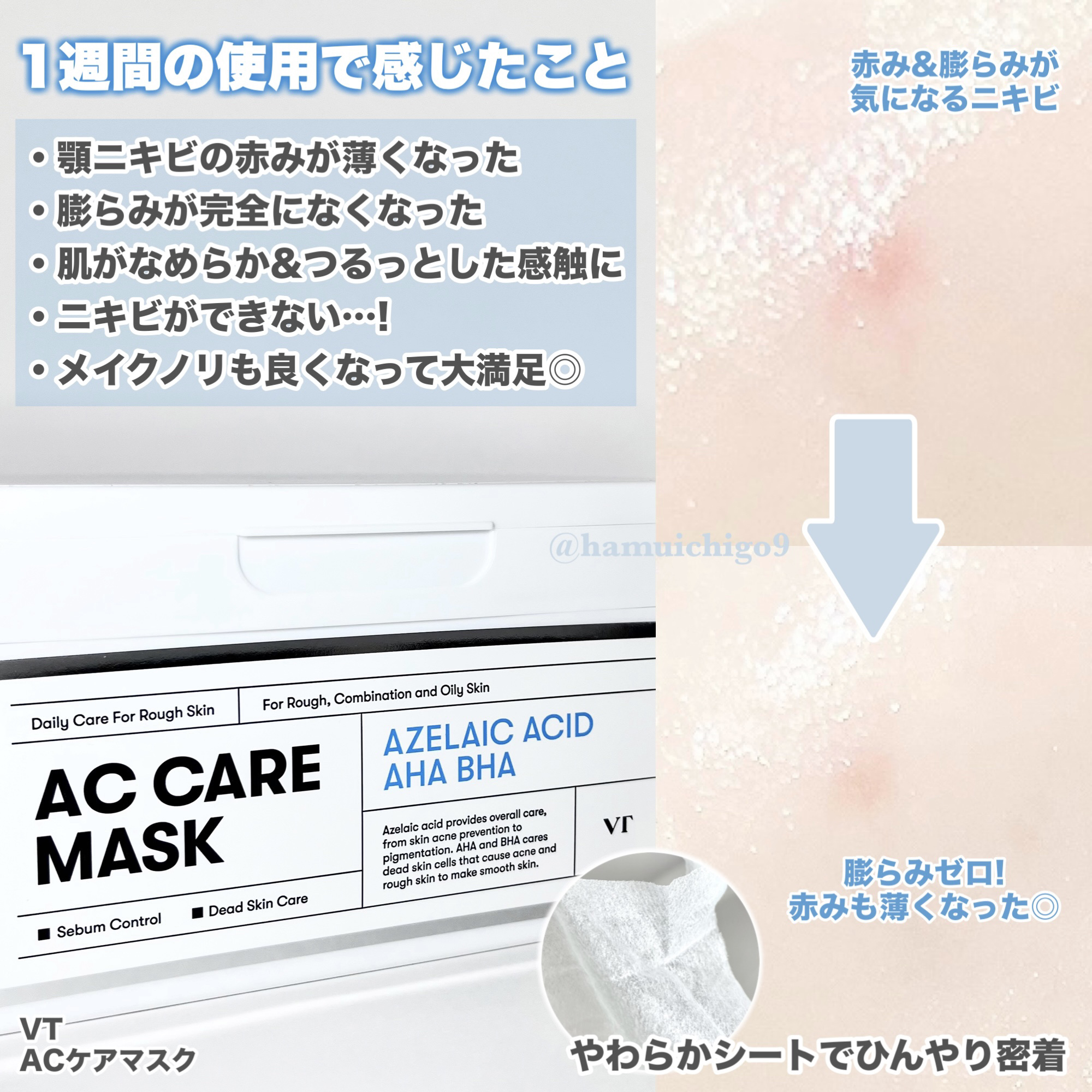 AZケア マスク/VT/シートマスク・パックを使ったクチコミ（2枚目）