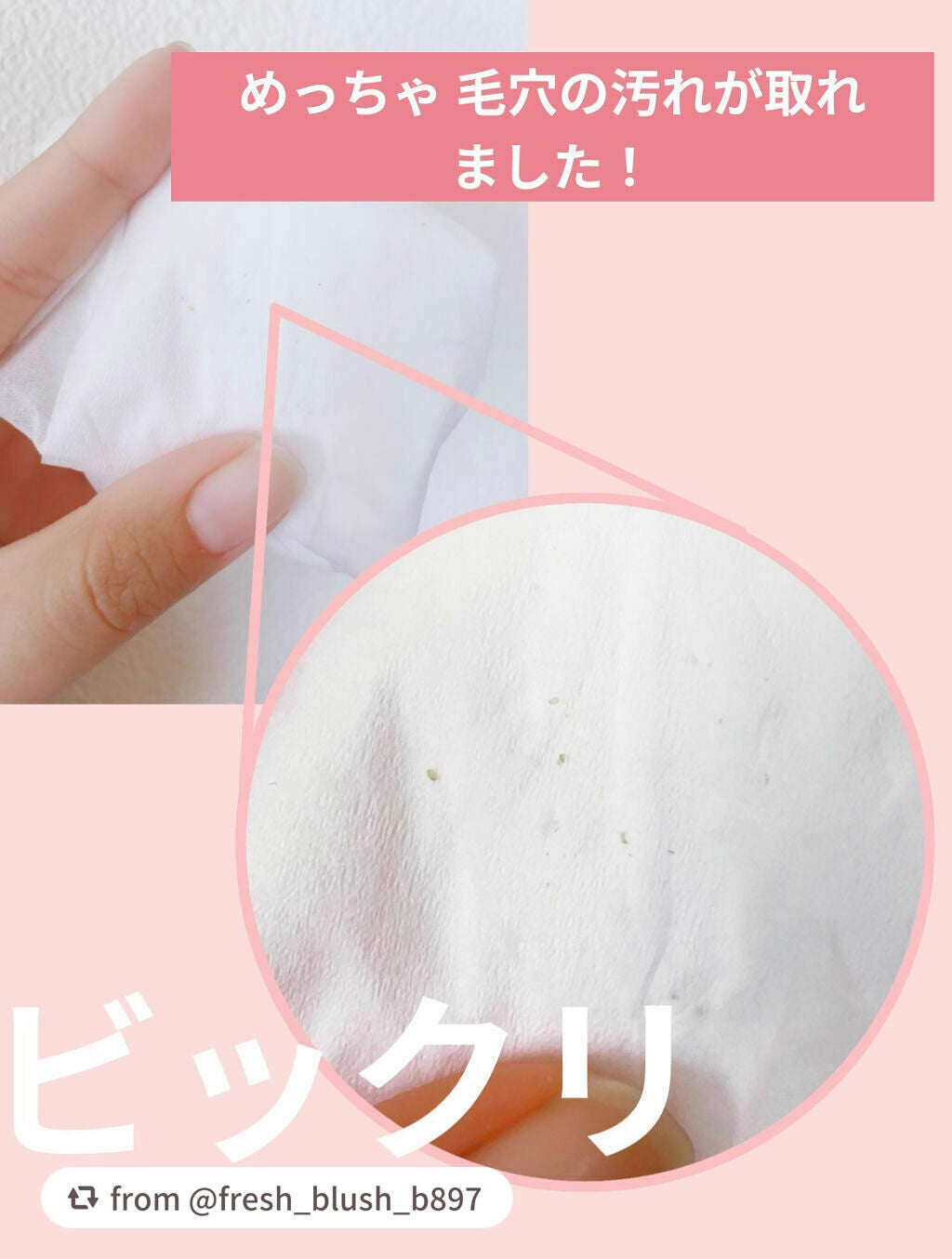 ごめんね素肌マスク/クリアターン/シートマスク・パックを使ったクチコミ(6枚目)