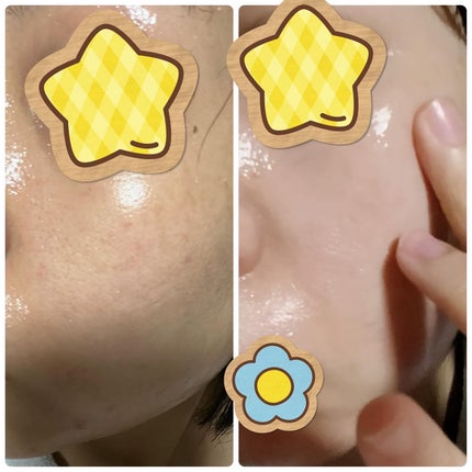 シーホース アンチオキシダントクリーム /Rarita/フェイスクリームを使ったクチコミ(7枚目)