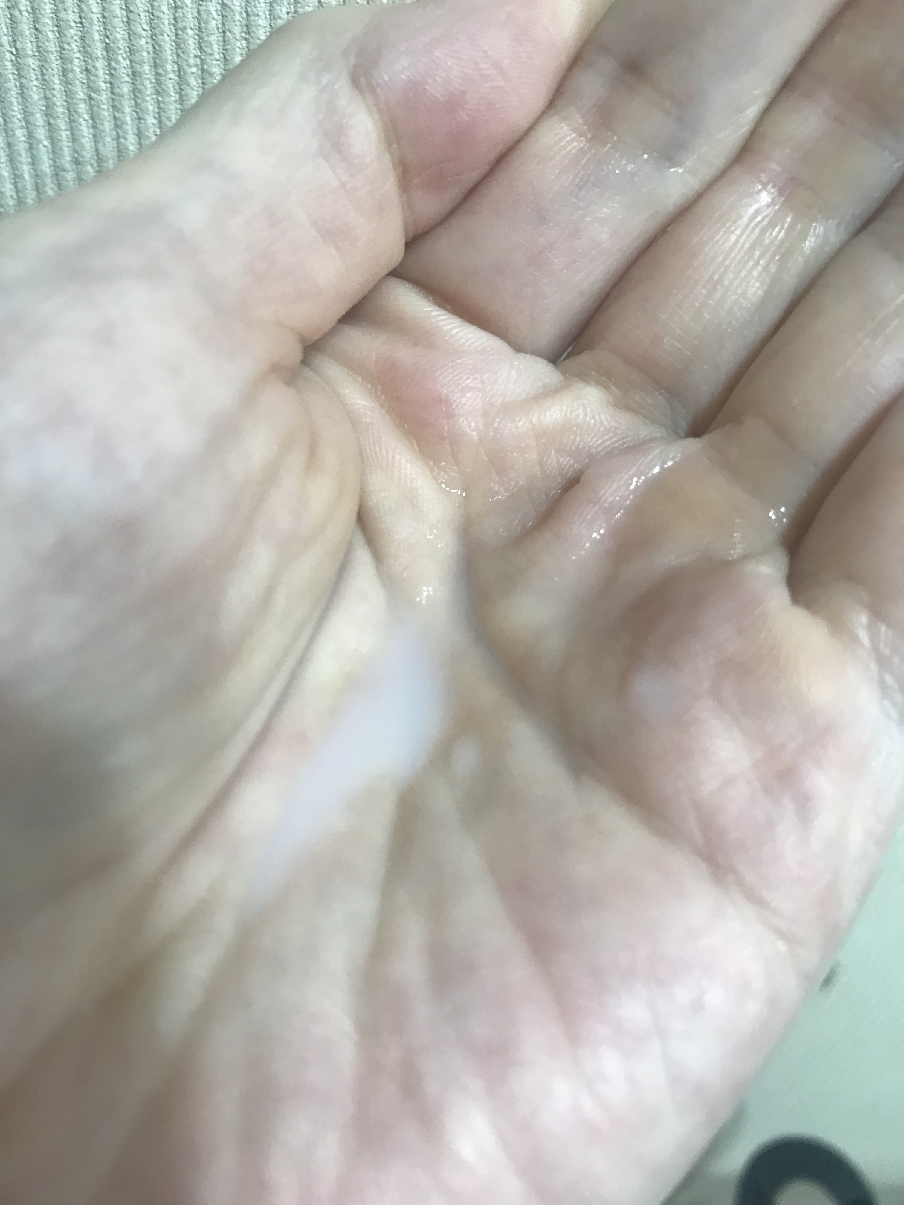 ロイヤルブラックスネイルファーストエッセンス/Dr.G/化粧水を使ったクチコミ（2枚目）