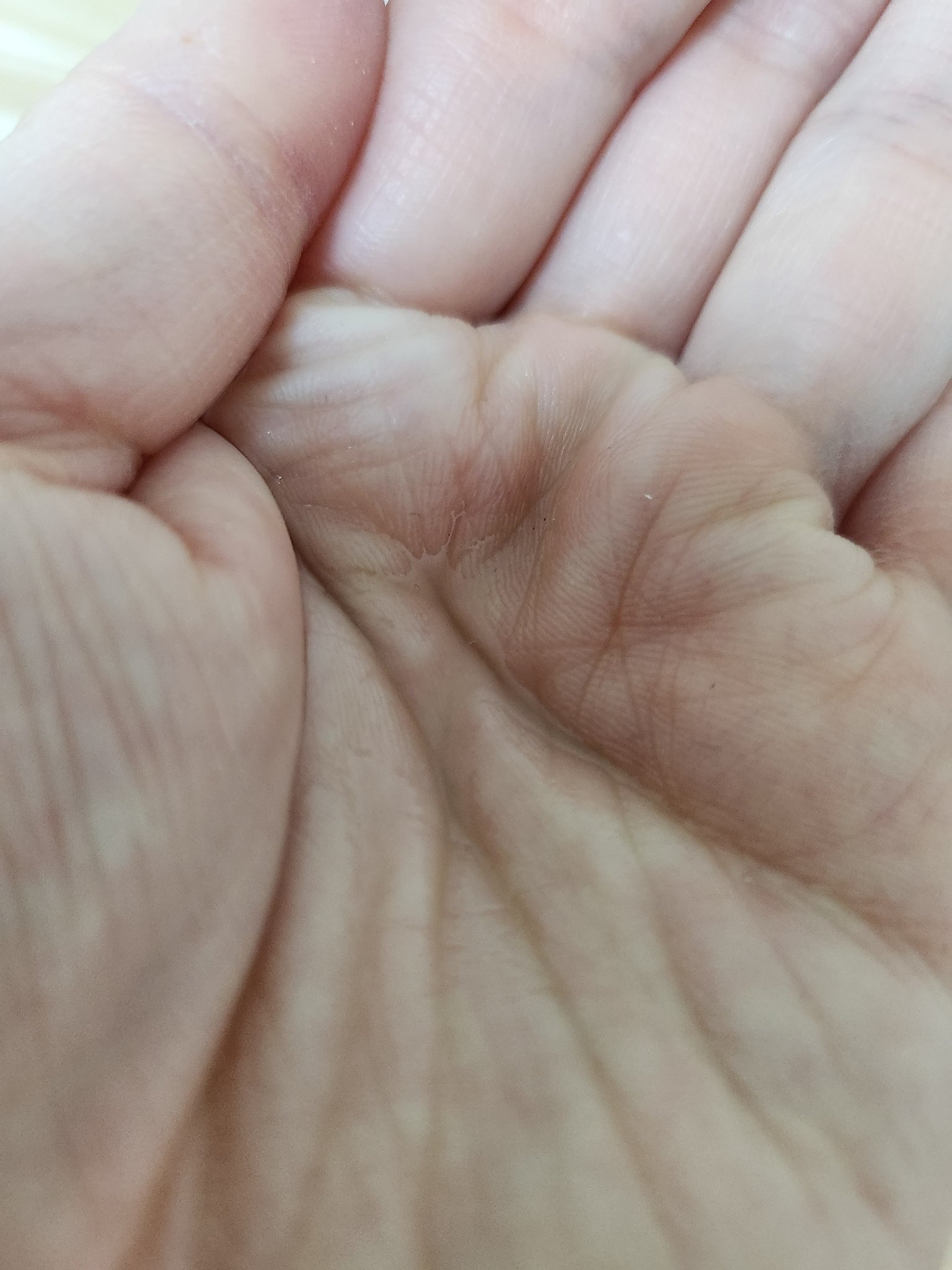 バイオ コンディショニング エッセンス/IOPE/ブースター・導入液を使ったクチコミ（2枚目）