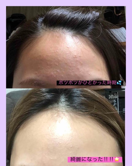 リセットクリアN/BENEFIQUE/化粧水を使ったクチコミ(2枚目)