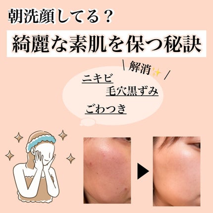 潤浸保湿 泡洗顔料/キュレル/泡洗顔を使ったクチコミ(1枚目)