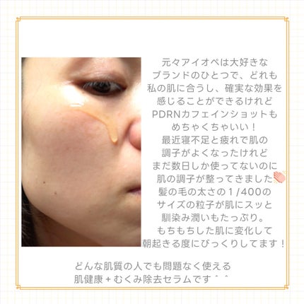 PDRNカフェインショット/IOPE/美容液を使ったクチコミ(5枚目)
