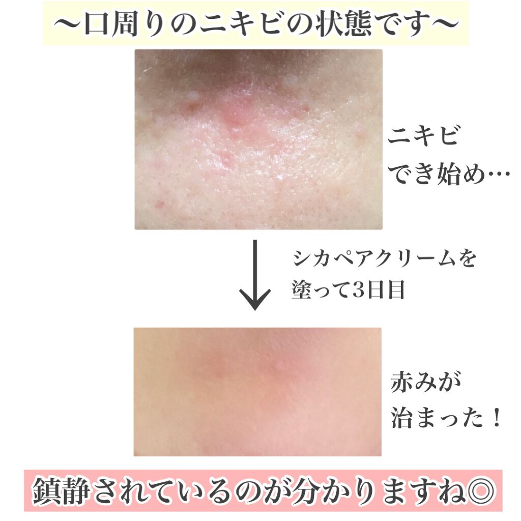 ドクタージャルト シカペア クリーム (第2世代)/Dr.Jart+/フェイスクリームを使ったクチコミ(3枚目)