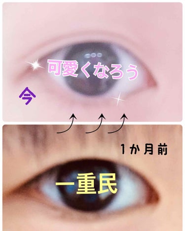 二重癖ずけの方法を教えたいと思います👁

私は、本当に重たーい一重でした😭
なので色々調べてマッサージやアイプチを買って色々試して見ました。だけど変化は、あまり無し(´△｀)↓ｶﾞｰﾝ……


皆さんに